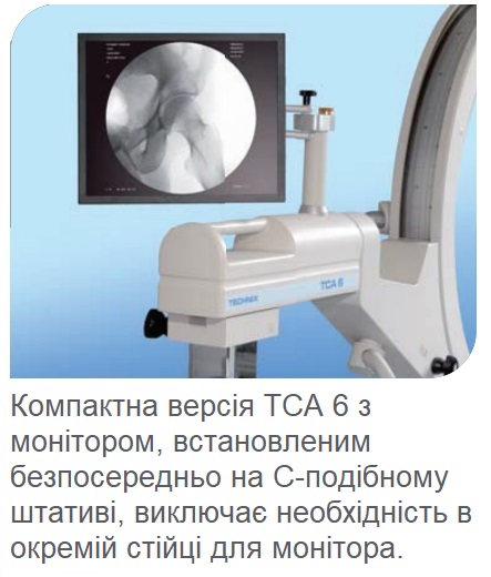 Мобільна С-дуга TECHNIX TCA 6 R/S